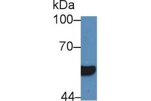 Western blot analysis of Human Serum, using Human HNF1b Antibody (5 µg/ml) and HRP-conjugated Goat Anti-Rabbit antibody ( (HNF1B anticorps  (AA 159-300))
