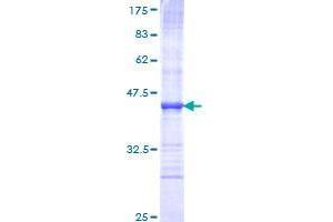 Image no. 1 for Sema Domain, Transmembrane Domain (TM), and Cytoplasmic Domain, (Semaphorin) 6A (SEMA6A) (AA 21-120) protein (GST tag) (ABIN1319490)