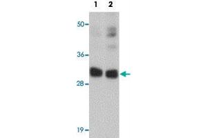 Western blot analysis of CCDC106 in human brain tissue lysate with CCDC106 polyclonal antibody  at (1) 0. (CCDC106 anticorps  (C-Term))