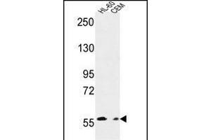 MILK2 Antibody (C-term) (ABIN651094 and ABIN2840068) western blot analysis in HL-60,CEM cell line lysates (35 μg/lane). (MICALL2 anticorps  (C-Term))