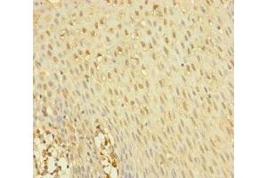 Immunohistochemistry of paraffin-embedded human tonsil tissue using ABIN7145012 at dilution of 1:100