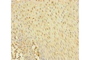 Immunohistochemistry of paraffin-embedded human tonsil tissue using ABIN7145012 at dilution of 1:100 (YME1L1 anticorps  (AA 1-240))