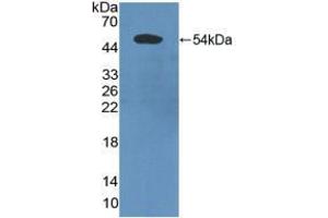 Western blot analysis of recombinant Human PDCD6IP. (ALIX anticorps  (AA 174-383))