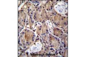 anti-LIM Domains Containing 1 (LIMD1) (AA 438-467), (C-Term) antibody