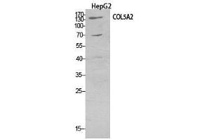 Western Blot (WB) analysis of HepG2 cells using COL5A2 Polyclonal Antibody. (COL5A2 anticorps  (Internal Region))