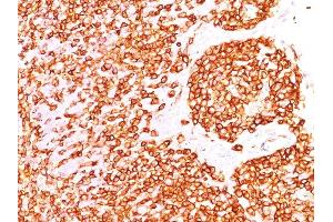 Formalin-fixed, paraffin-embedded human Tonsil stained with CD45RB Monoclonal Antibody (DF-B1). (CD45 anticorps)