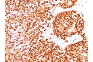 Formalin-fixed, paraffin-embedded human Tonsil stained with CD45RB Monoclonal Antibody (DF-B1).