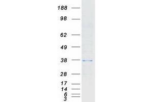 Validation with Western Blot