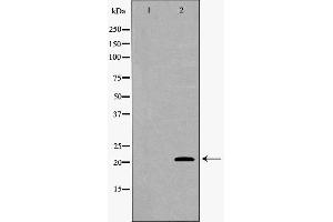 Western blot analysis of A549 whole cell lysates, using SFTPC Antibody.