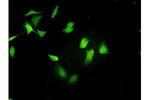 Immunofluorescence of monoclonal antibody to STAT4 on HeLa cell.