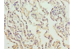 Immunohistochemistry of paraffin-embedded human lung tissue using ABIN7148251 at dilution of 1:100 (COL4a3 anticorps  (AA 1427-1668))