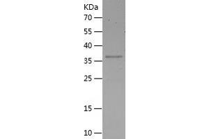 Western Blotting (WB) image for Poly (ADP-Ribose) Polymerase 2 (PARP2) (AA 430-583) protein (His-IF2DI Tag) (ABIN7124503)