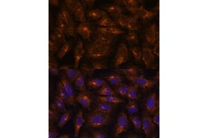 Immunofluorescence analysis of U-2 OS cells using [KO] IFITM3 antibody (ABIN6130482, ABIN6142186, ABIN6142187 and ABIN7101416) at dilution of 1:100. (IFITM3 anticorps  (AA 1-133))