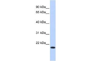 WB Suggested Anti-IRF7 Antibody Titration:  0. (IRF7 anticorps  (N-Term))