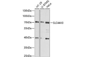 Western blot analysis of extracts of various cell lines, using SLC44 antibody (ABIN6130186, ABIN6148002, ABIN6148003 and ABIN6216584) at 1:3000 dilution. (SLC44A3 anticorps  (AA 60-220))