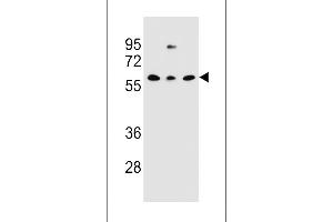 Western blot analysis in NCI-H460,293,MDA-MB231 cell line lysates (35ug/lane). (CLEC17A anticorps  (C-Term))