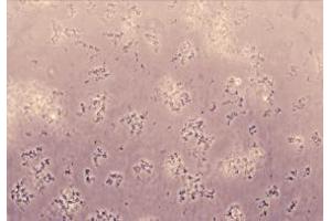 The activity of recombinant Human PRF1 Protein was observed with a hemolysis assay measuring lysis of rabbit erythrocytes (RaE). (Perforin 1 Protéine)