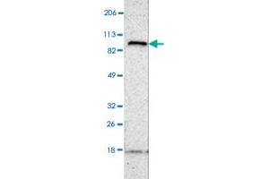 Western blot analysis of human cell line RT-4 with FANCB polyclonal antibody . (FANCB anticorps)