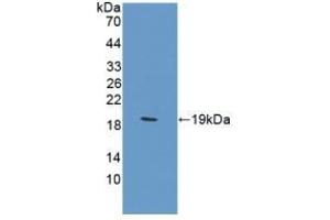 Detection of Recombinant CA12, Rat using Polyclonal Antibody to Carbonic Anhydrase XII (CA12) (CA12 anticorps  (AA 154-307))