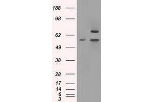 Image no. 2 for anti-Protein Phosphatase 5, Catalytic Subunit (PPP5C) antibody (ABIN1500391) (PP5 anticorps)