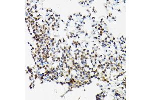 Immunohistochemistry of paraffin-embedded Rat lung using SRSF2 antibody (ABIN1682677, ABIN3017915, ABIN3017916, ABIN5664377 and ABIN6220303) at dilution of 1:100 (40x lens).