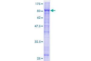 Image no. 1 for Cell Division Cycle 23 (CDC23) (AA 1-591) protein (GST tag) (ABIN1348786)