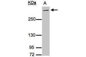 WB Image Sample (30μg whole cell lysate) A:Raji , 5% SDS PAGE antibody diluted at 1:3000 (MUC2 anticorps  (C-Term))