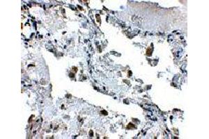 Immunohistochemistry of SH3BP4 in human lung tissue with SH3BP4 polyclonal antibody  at 5 ug/mL .
