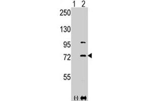 Western blot analysis of PAK1 (arrow) using PAK1 polyclonal antibody . (PAK1 anticorps  (Thr423))