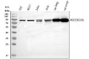 Western blot analysis of FOXO3A using anti-FOXO3A antibody (ABIN3042404). (FOXO3 anticorps  (AA 471-673))