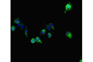 Immunofluorescent analysis of Hela cells using ABIN7163856 at dilution of 1:100 and Alexa Fluor 488-congugated AffiniPure Goat Anti-Rabbit IgG(H+L) (GALNT11 anticorps  (AA 420-606))