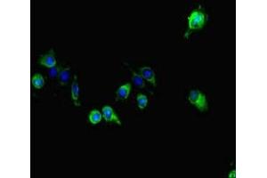 Immunofluorescent analysis of Hela cells using ABIN7163856 at dilution of 1:100 and Alexa Fluor 488-congugated AffiniPure Goat Anti-Rabbit IgG(H+L) (GALNT11 anticorps  (AA 420-606))