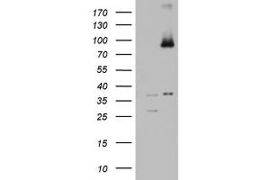 Western Blotting (WB) image for anti-ATP-Binding Cassette, Sub-Family D (Ald), Member 1 (ABCD1) (AA 508-745) antibody (ABIN2715622) (ABCD1 anticorps  (AA 508-745))