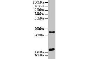Western Blot All lanes: EMP3 antibody at 3 μg/mL + Mouse heart tissue Secondary Goat polyclonal to rabbit IgG at 1/10000 dilution Predicted band size: 19 kDa Observed band size: 19, 31 kDa (EMP3 anticorps  (AA 25-65))