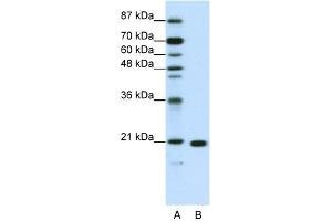 WB Suggested Anti-RPL9 Antibody Titration:  1. (RPL9 anticorps  (C-Term))