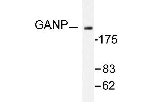 Image no. 1 for anti-Minichromosome Maintenance Complex Component 3 Associated Protein (MCM3AP) antibody (ABIN265431) (GANP anticorps)
