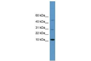 WB Suggested Anti-HMGA1 Antibody Titration:  0. (HMGA1 anticorps  (N-Term))