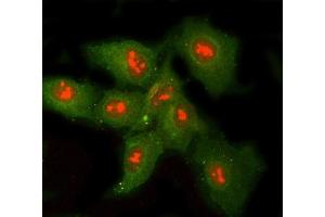IF analysis of RNASEH1 and Tubulin beta using anti-RNASEH1 antibody (ABIN7602317) and anti-Tubulin beta antibody (ABIN7602744).