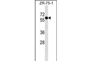 ZN Antibody (N-term) (ABIN1539306 and ABIN2849390) western blot analysis in ZR-75-1 cell line lysates (35 μg/lane). (ZNF503 anticorps  (N-Term))