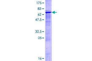 Image no. 1 for Mitogen-Activated Protein Kinase Kinase 4 (MAP2K4) (AA 1-399) protein (GST tag) (ABIN1310179)