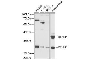 Western blot analysis of extracts of various cell lines, using KCNJ11 antibody (ABIN6129430, ABIN6142721, ABIN6142722 and ABIN6221442) at 1:1000 dilution. (KCNJ11 anticorps  (AA 171-390))