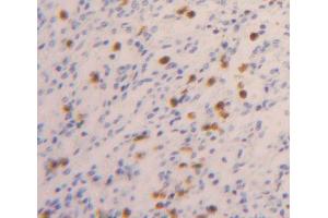 Used in DAB staining on fromalin fixed paraffin- embedded Kidney tissue