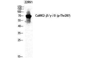 Western Blotting (WB) image for anti-CaMKIIbeta/gamma/delta (pThr287) antibody (ABIN3182661) (CaMKIIbeta/gamma/delta anticorps  (pThr287))