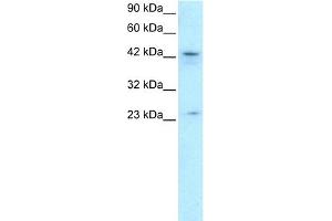 WB Suggested Anti-ZNF365 Antibody Titration: 0.