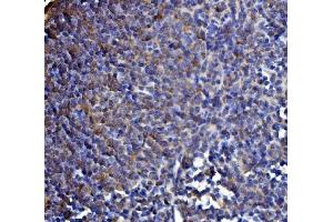 IHC analysis of DLST using anti-DLST antibody (ABIN7599412). (DLST anticorps  (AA 1-453))