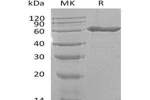 Western Blotting (WB) image for 5'-Nucleotidase, Ecto (CD73) (NT5E) protein (His tag) (ABIN7320735)