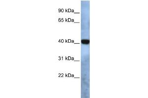 WB Suggested Anti-TMEM115 Antibody Titration:  0. (TMEM115 anticorps  (N-Term))