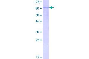 Image no. 1 for Interferon Regulatory Factor 5 (IRF5) (AA 1-498) protein (GST tag) (ABIN1308090)