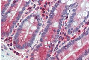 Anti-ESYT1 / FAM62A antibody  ABIN960776 IHC staining of human small intestine.