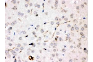 IHC analysis of Ceruloplasmin/CP using anti-Ceruloplasmin/CP antibody (ABIN3044508). (Ceruloplasmin anticorps  (AA 20-258))